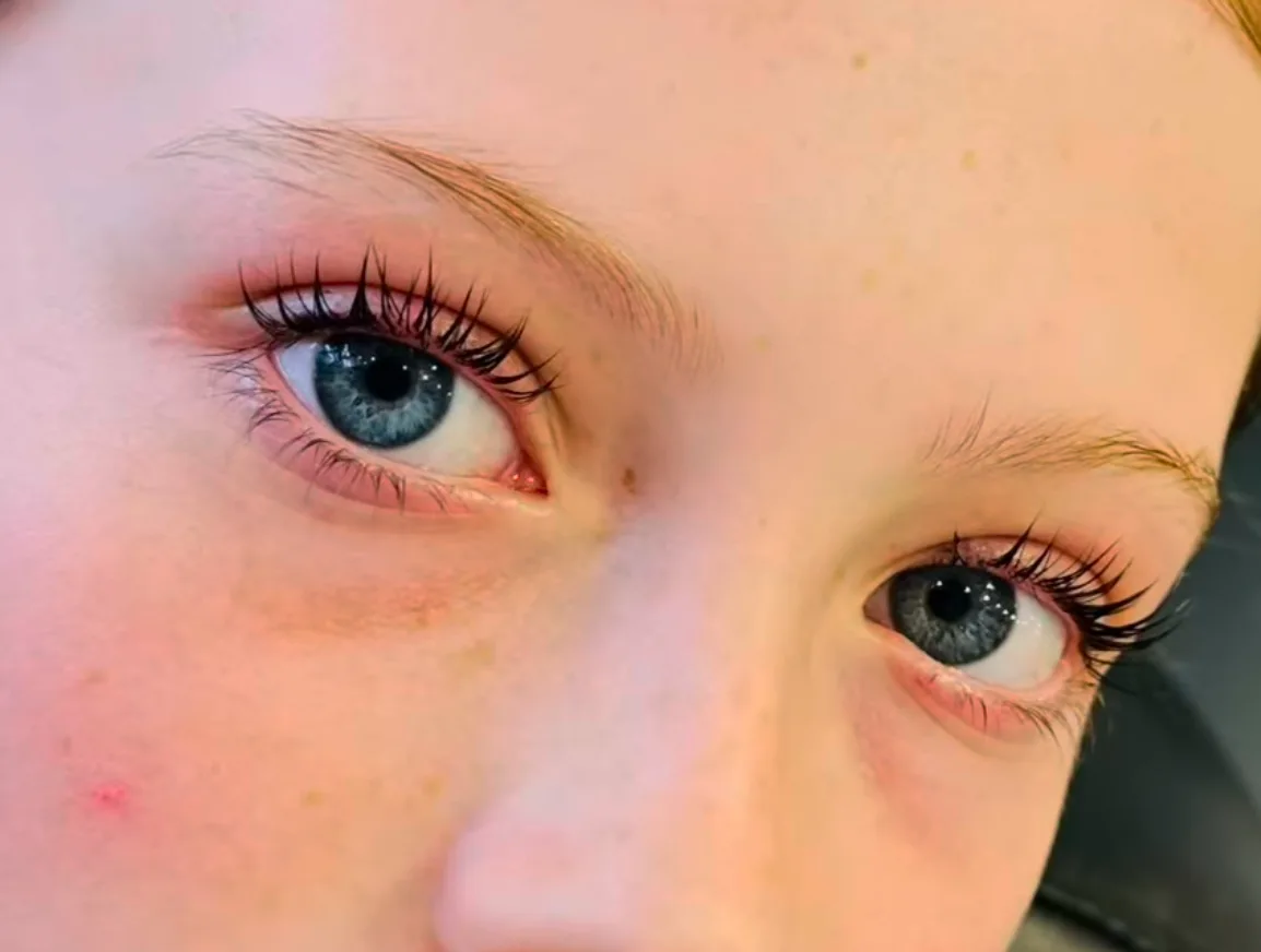 Young client's eye after a lash lift and tint with freckled skin