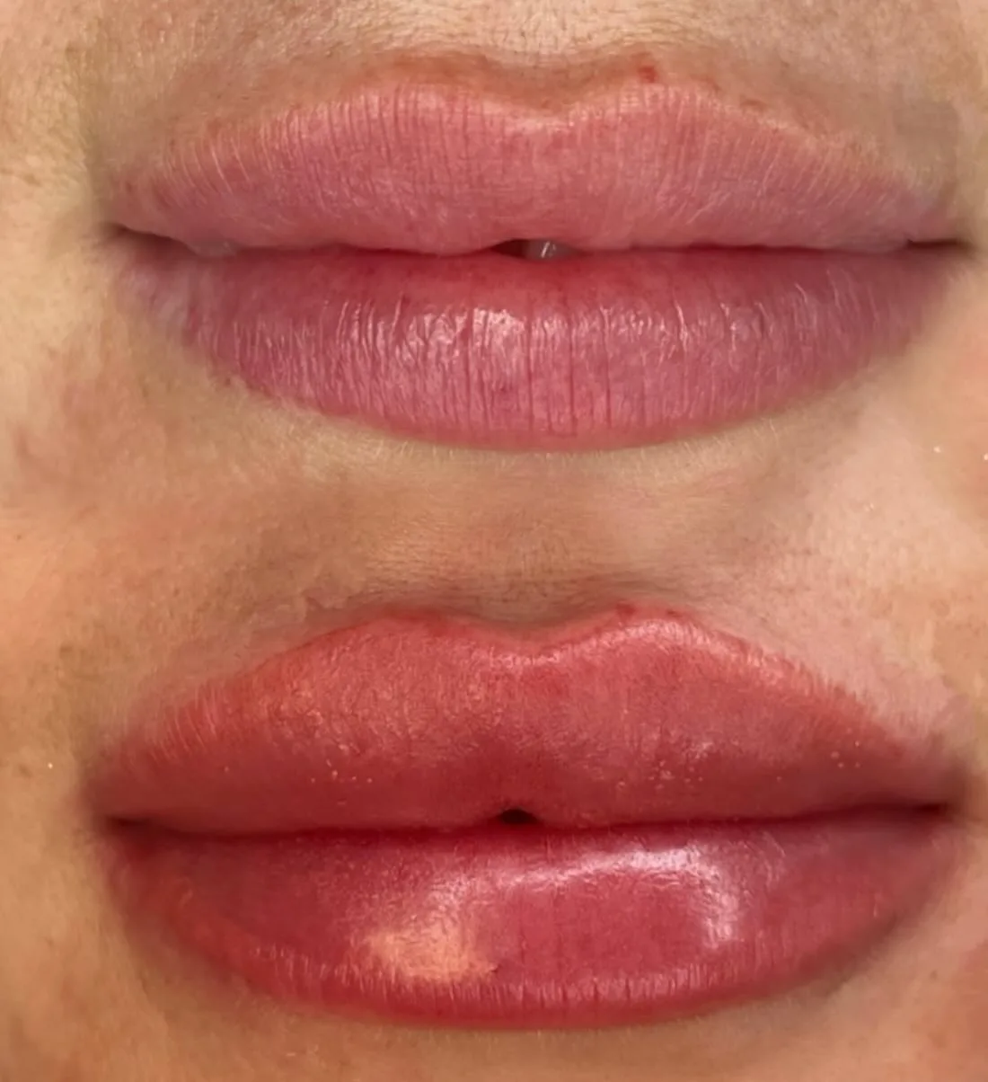 Lip blush result — natural lips to enhanced